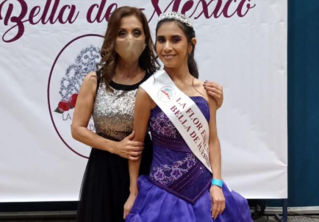 Milagro, pasó de casi morir a ser la Flor Especial más Bella de Puebla