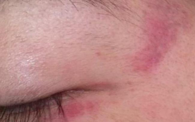 Por violencia doméstica denuncian a funcionario de Texmelucan