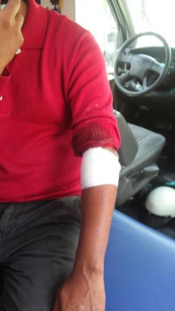 Lesionan a 2 hombres durante intento de asalto en Moyotzingo image 2