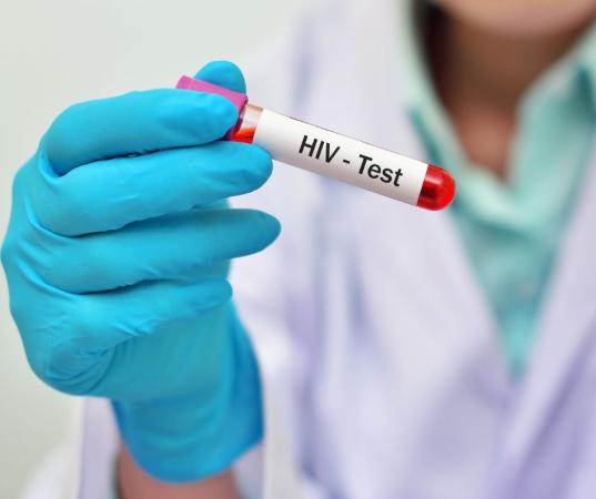 De cada 100 personas que viven con VIH en México, seis son adultas mayores