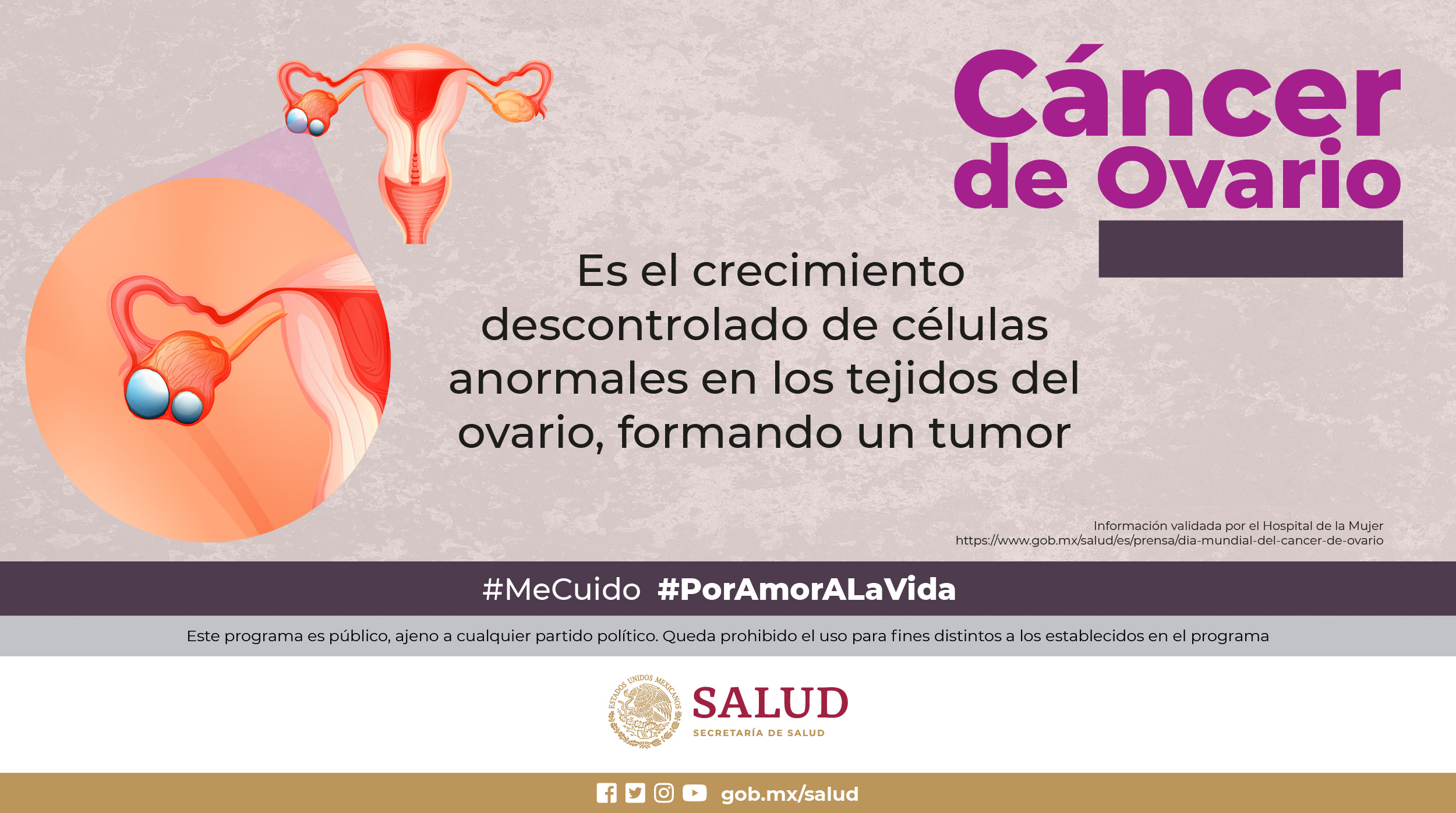Cáncer de ovario, de los más agresivos si no se detecta y atiende a tiempo
