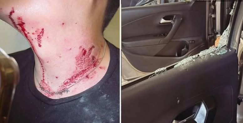Lesionan a conductor tras arrojarle piedras sobre Periférico-Ecológico 