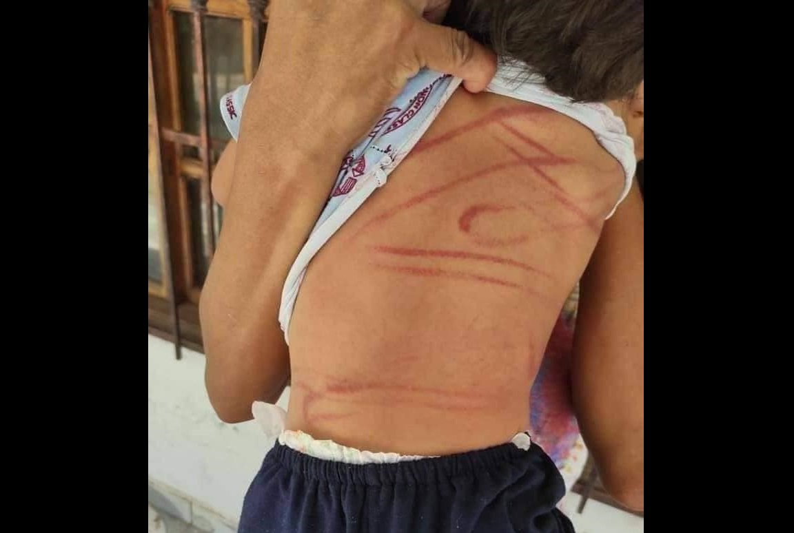 A cintazos castiga al hijo de su inquilina por arrancar sus plantas