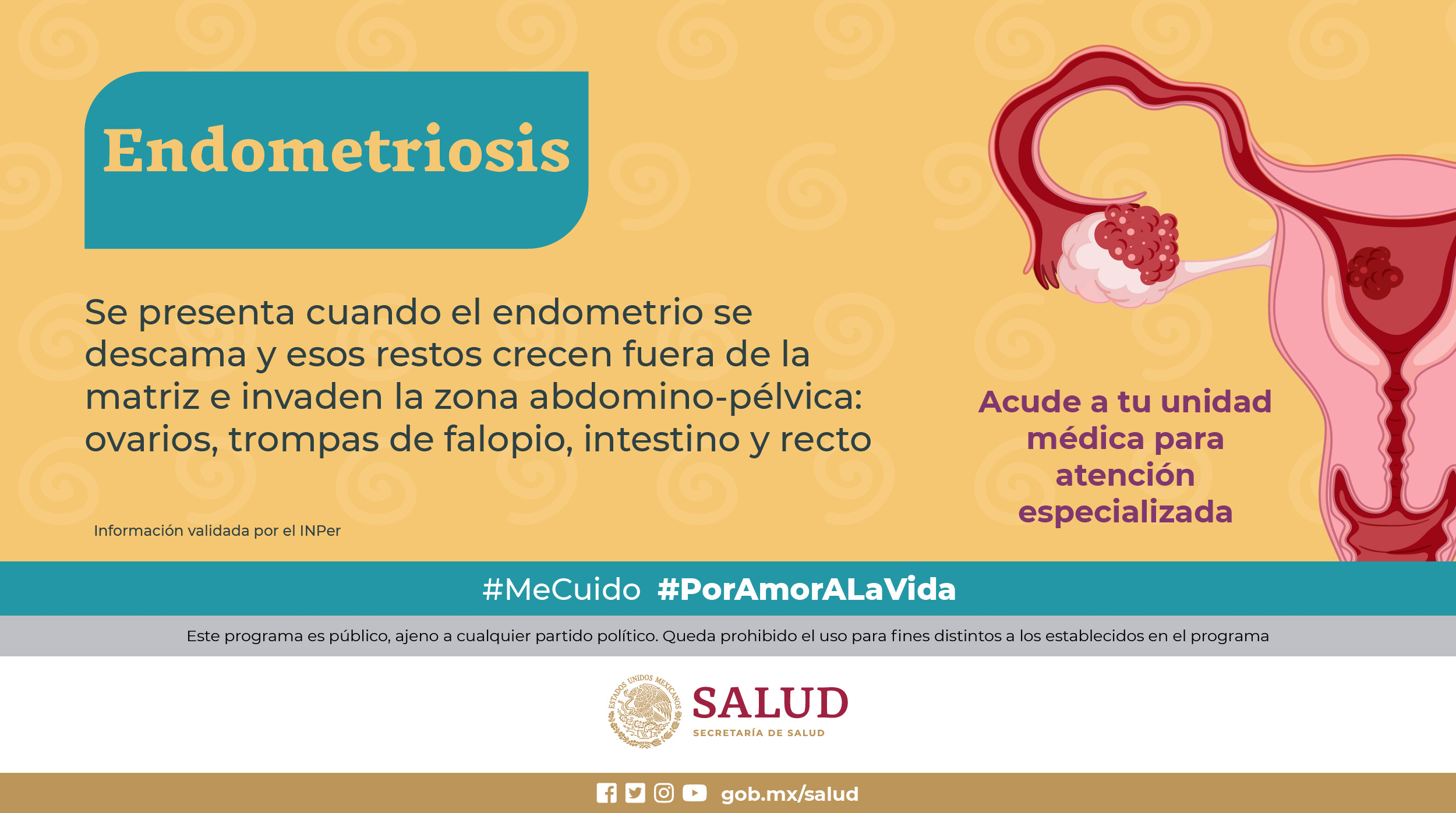 En México, el 10% de mujeres en edad reproductiva puede padecer endometriosis