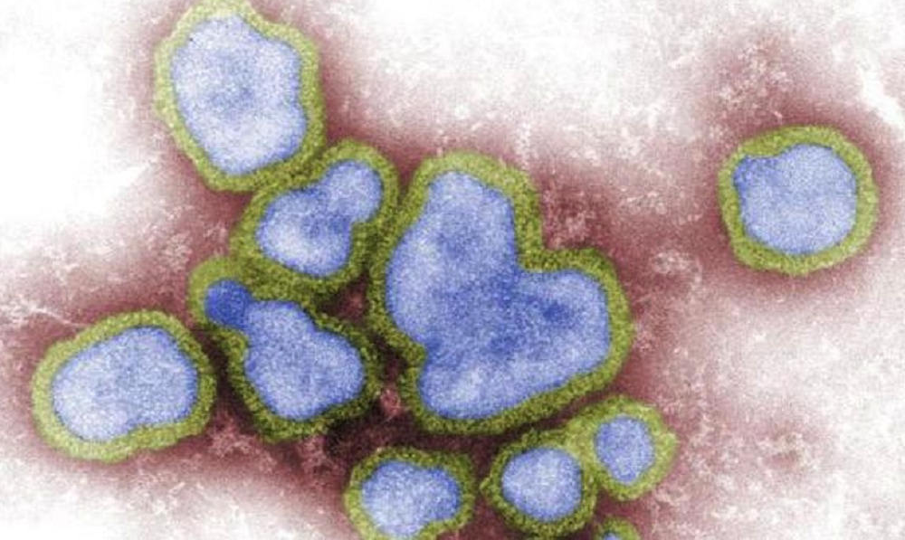 OMS registra primer fallecimiento por gripe aviar H3N8 en China