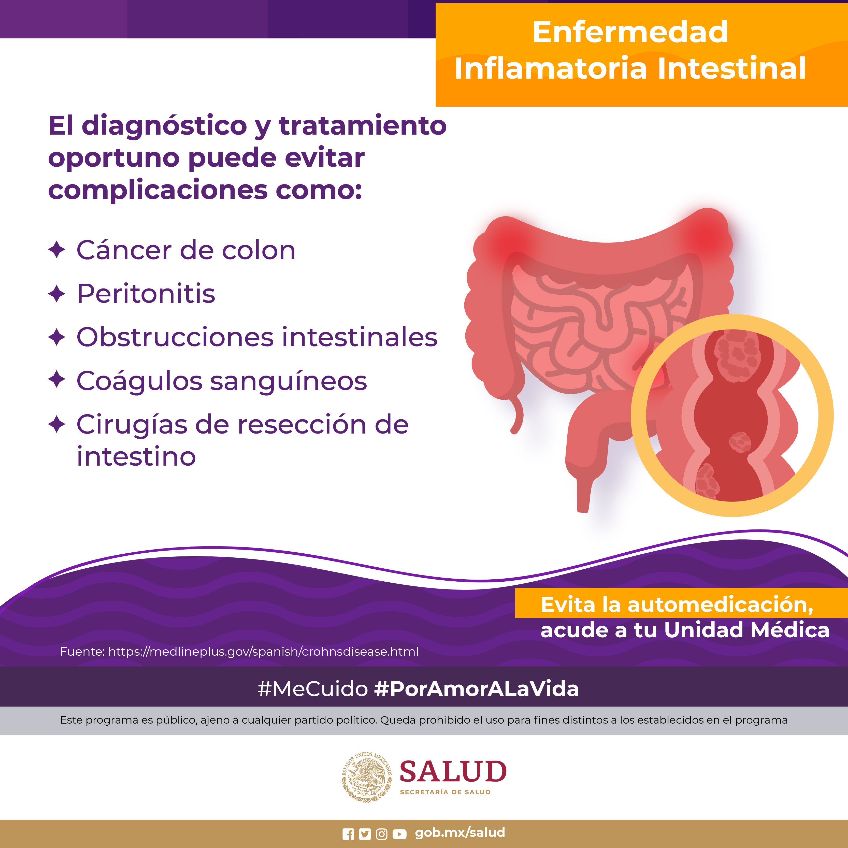 Cuidado: Enfermedad inflamatoria intestinal, padecimiento autoinmune
