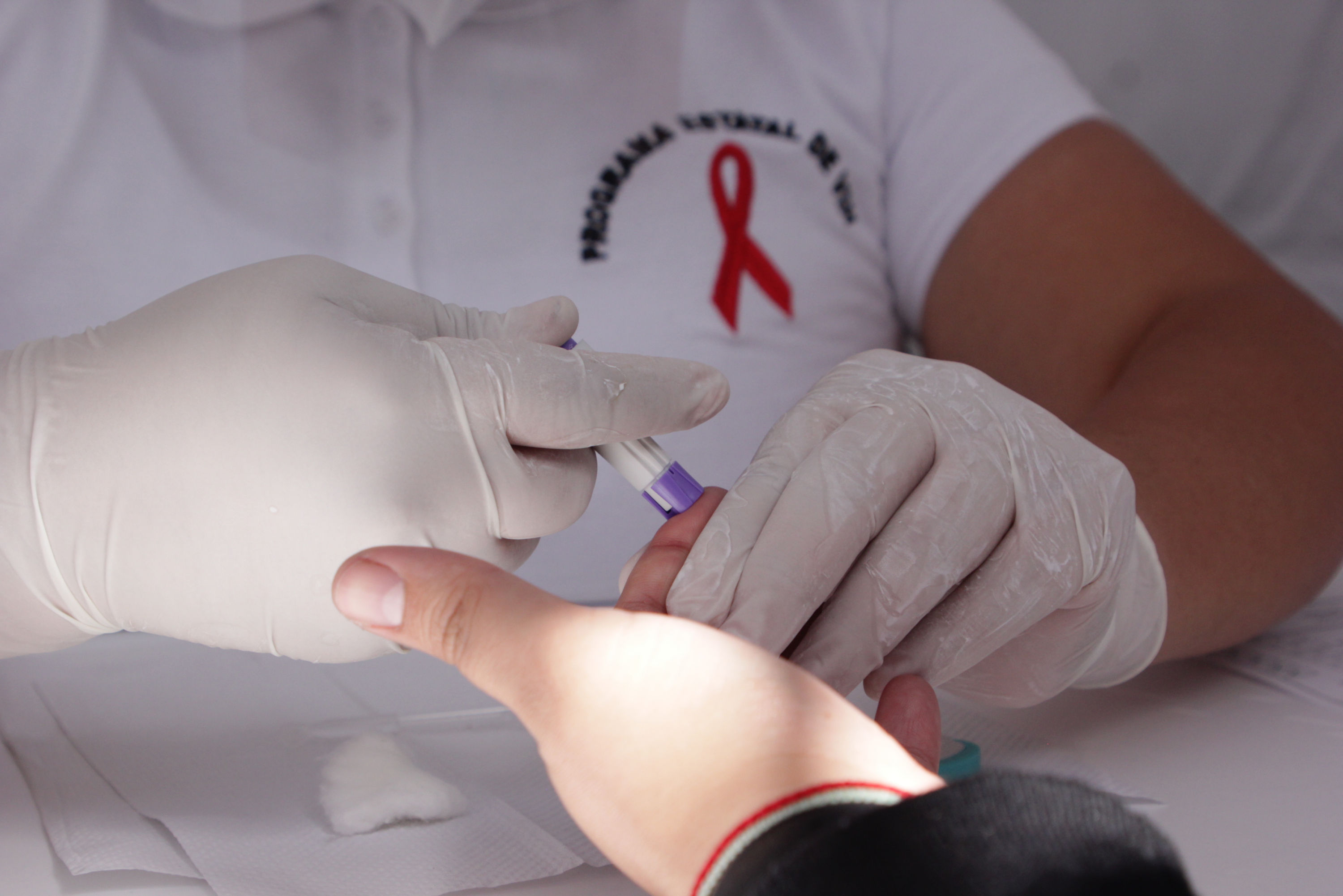 Por VIH, 158 personas fallecieron en Puebla en el 2021