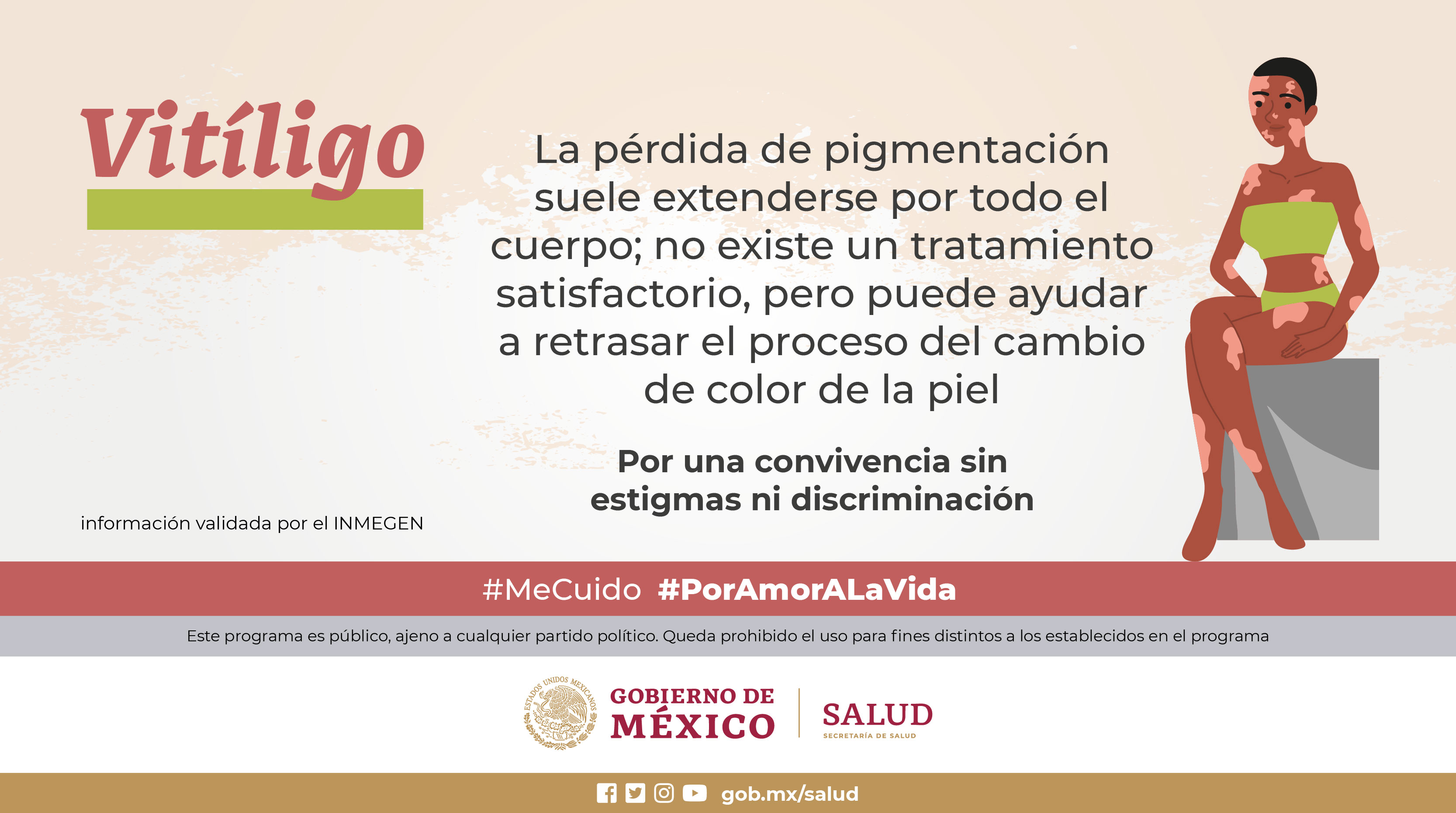 Vitíligo, tercer lugar en consultas dermatológicas en México