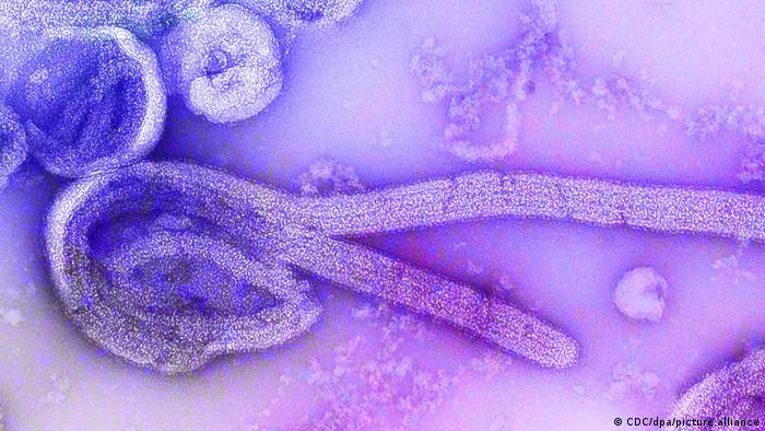Guinea Ecuatorial confirmó brote del virus de Marburgo, igual de letal que el ébola