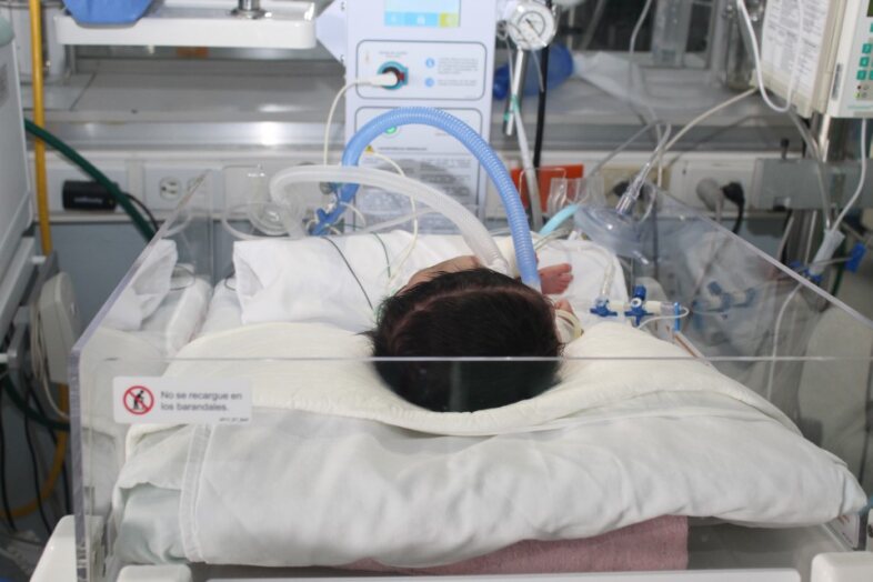 IMSS retiran tumor de 20 centímetros del rostro y cuello de recién nacida