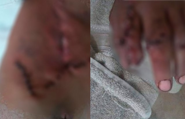 Mutilan dedos a otro taxista durante asalto en la Puebla-Orizaba