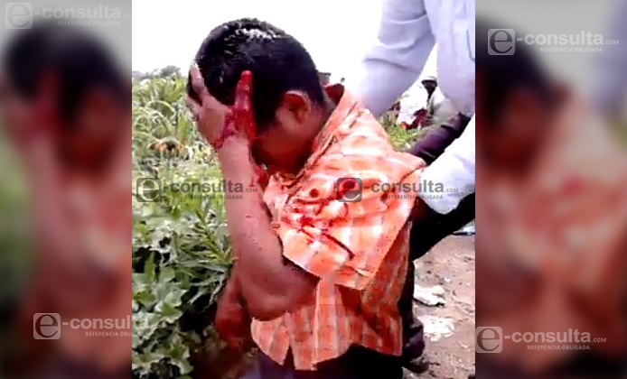 Bala de goma perforó cabeza de niño en Chalchihuapan