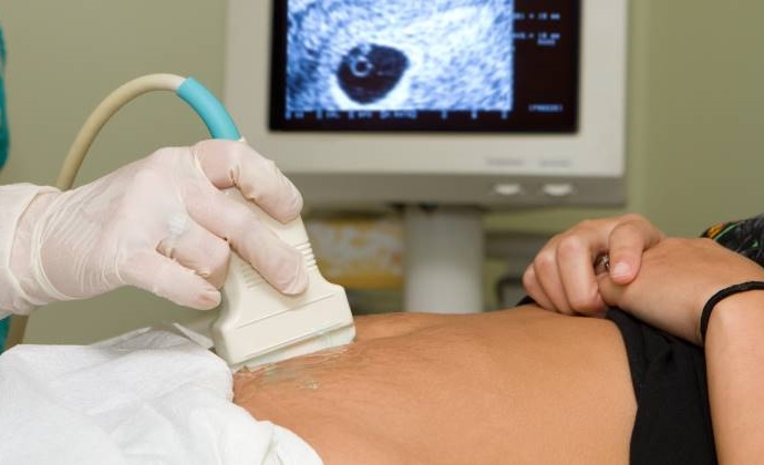 Colectivos pedirán que candidatos de Morena se comprometan a legalizar el aborto