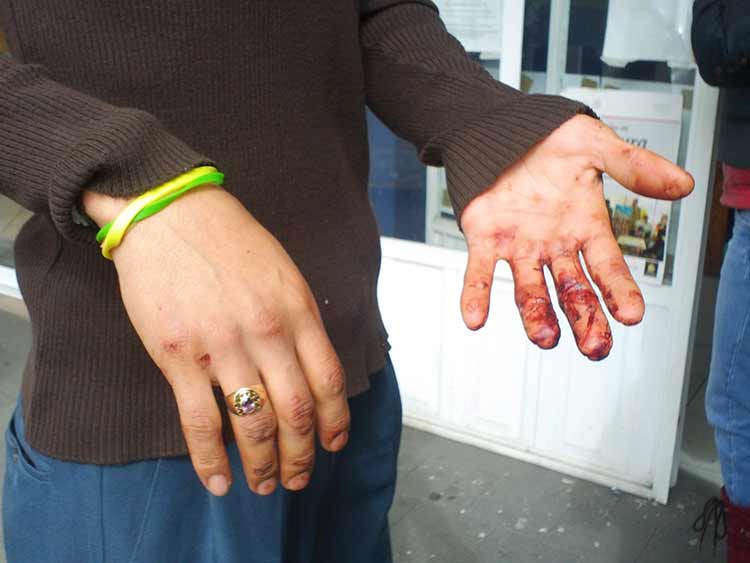Policías municipales golpean y detienen a jóvenes en Teziutlán