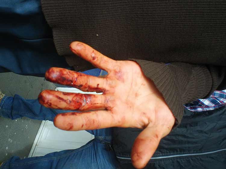 Policías municipales golpean y detienen a jóvenes en Teziutlán