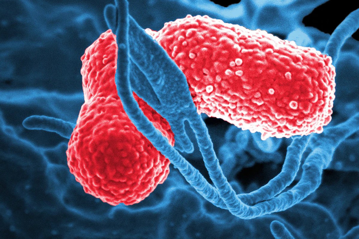 Brote de Klebsiella oxytoca: síntomas, riesgos y cómo evitar su propagación