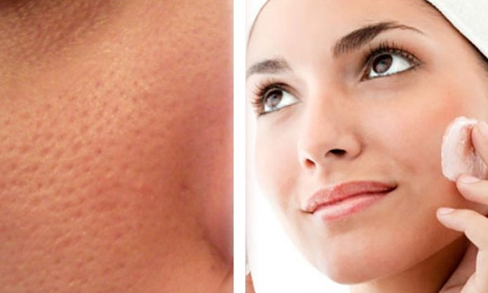 Mejora la apariencia de los poros 