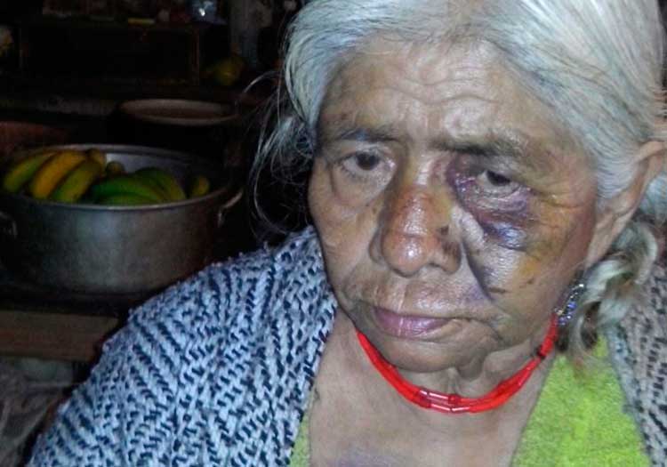 Golpean a pareja de ancianos en Xochitlán para robarles 50 mil pesos