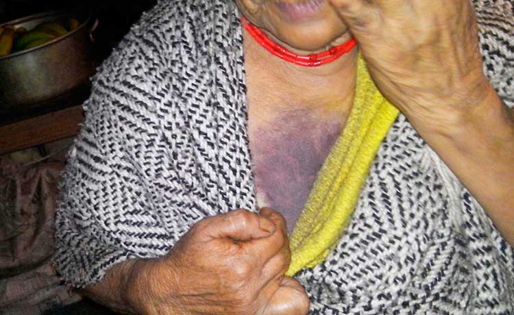 Golpean a pareja de ancianos en Xochitlán para robarles 50 mil pesos