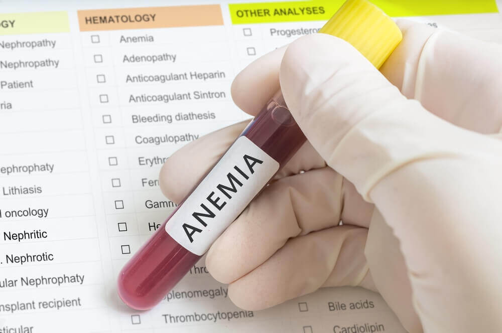Anemia, enfermedad silenciosa debido al desorden nutricional: IMSS