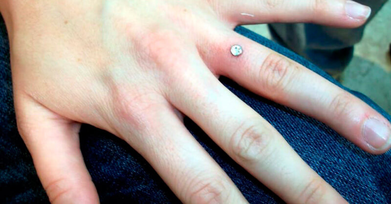 Nueva tendencia, anillos de piedras preciosas incrustados en la piel