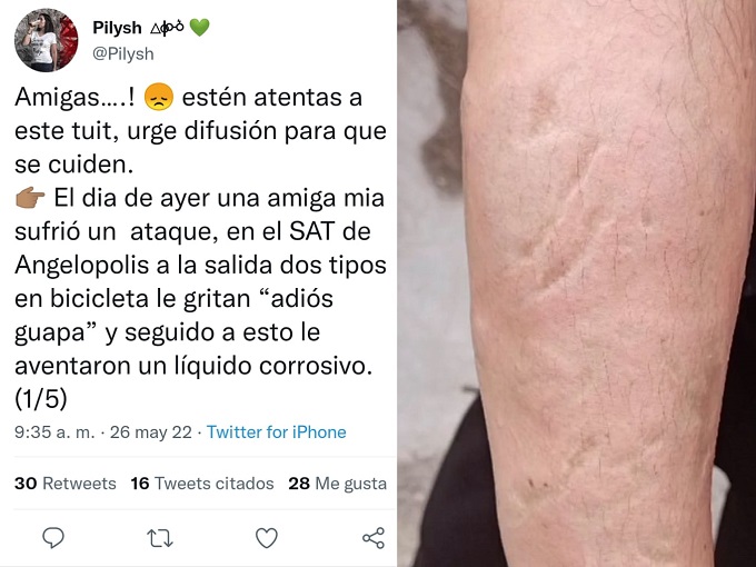 Proponen 21 años de cárcel a quien ataque con ácido a mujeres en Puebla