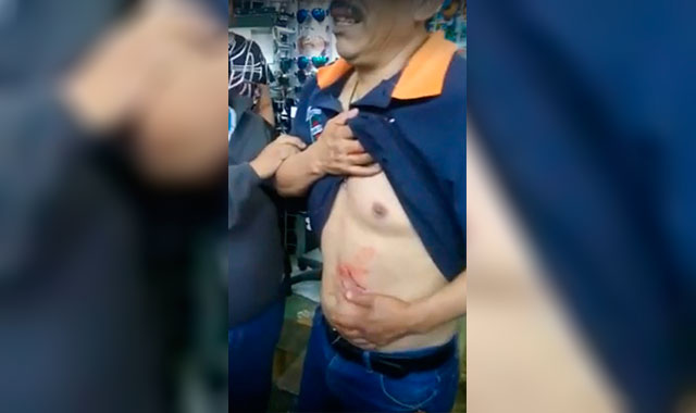 Perro policía ataca a hombre en portal del centro de Huauchinango