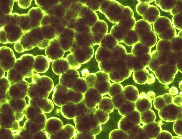 Advierten sobre bacteria Citrobacter que ha matado a cuatro bebés