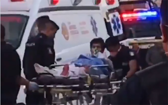 Balean a joven en la pierna en taller de San Andrés Cholula