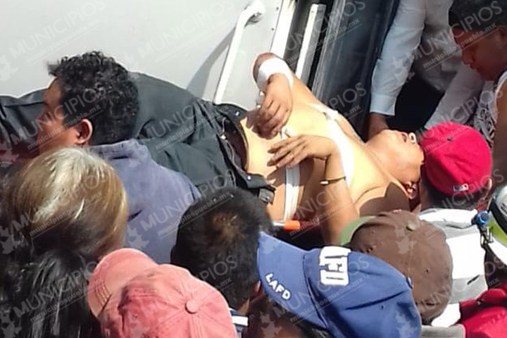 En intento de asalto balean a chófer en Xalmimilulco