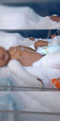 Investigan a papás de bebé fracturado en Huauchinango