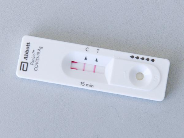 Reporta Salud 9 casos activos de covid en Puebla; suman 389 contagios