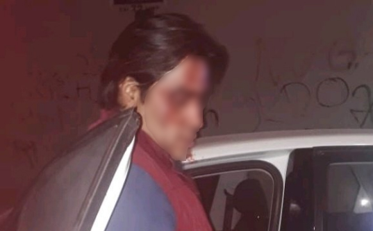 Golpean e intenta asaltar a chofer de Cabify en la Romero Vargas, Puebla