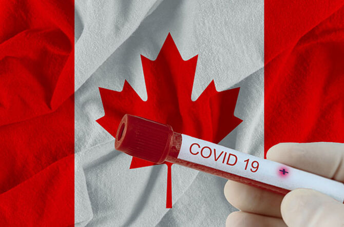 Detectan primeros casos en Canadá de variante Ómicron