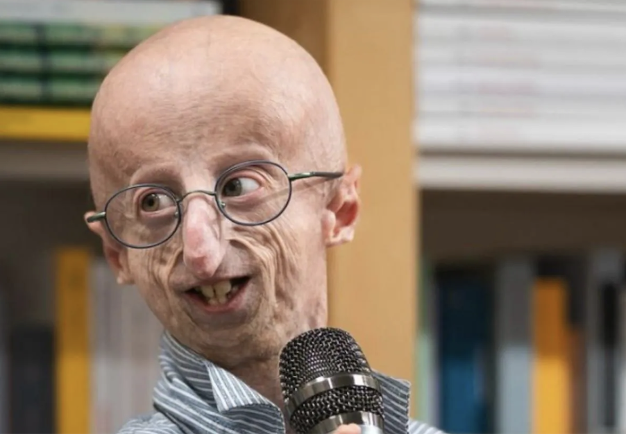 Muere a los 28 años Sammy Basso, la persona con progeria más longeva del mundo