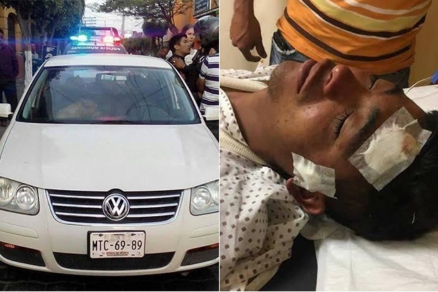 Conductor golpea a ciclista con bat y lo manda al hospital en Tehuacán