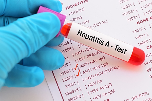 Reportan brote de hepatitis A en Xochitlán de Vicente Suárez
