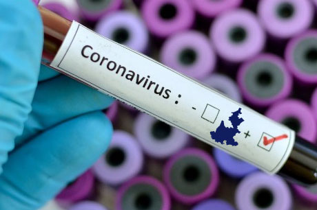 En 24 horas se infectan de coronavirus 54 poblanos