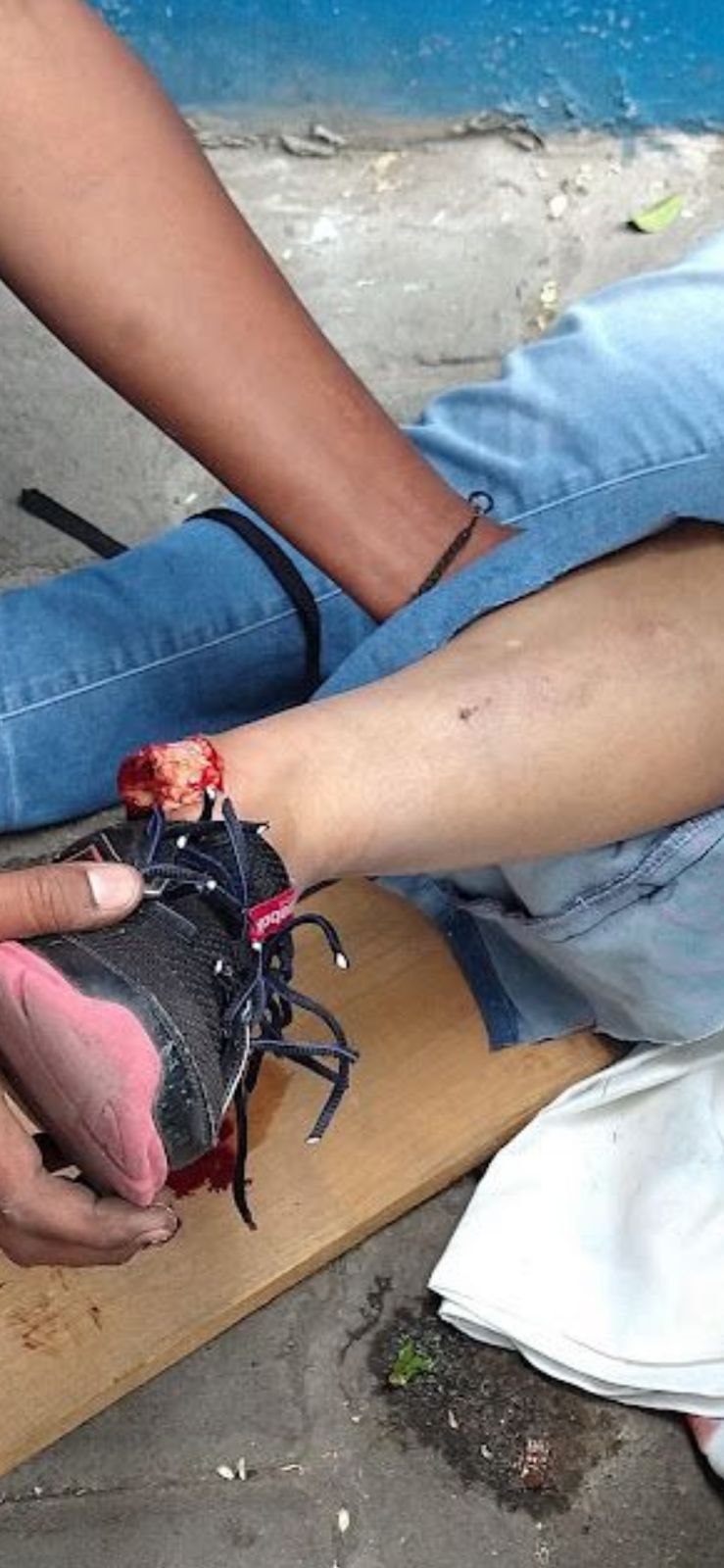 Mujer cae de puente y termine con pie desprendido en Atlixco