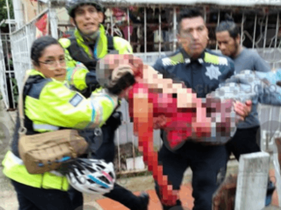 Tras riña dejan gravemente herido a hombre en Agua Santa