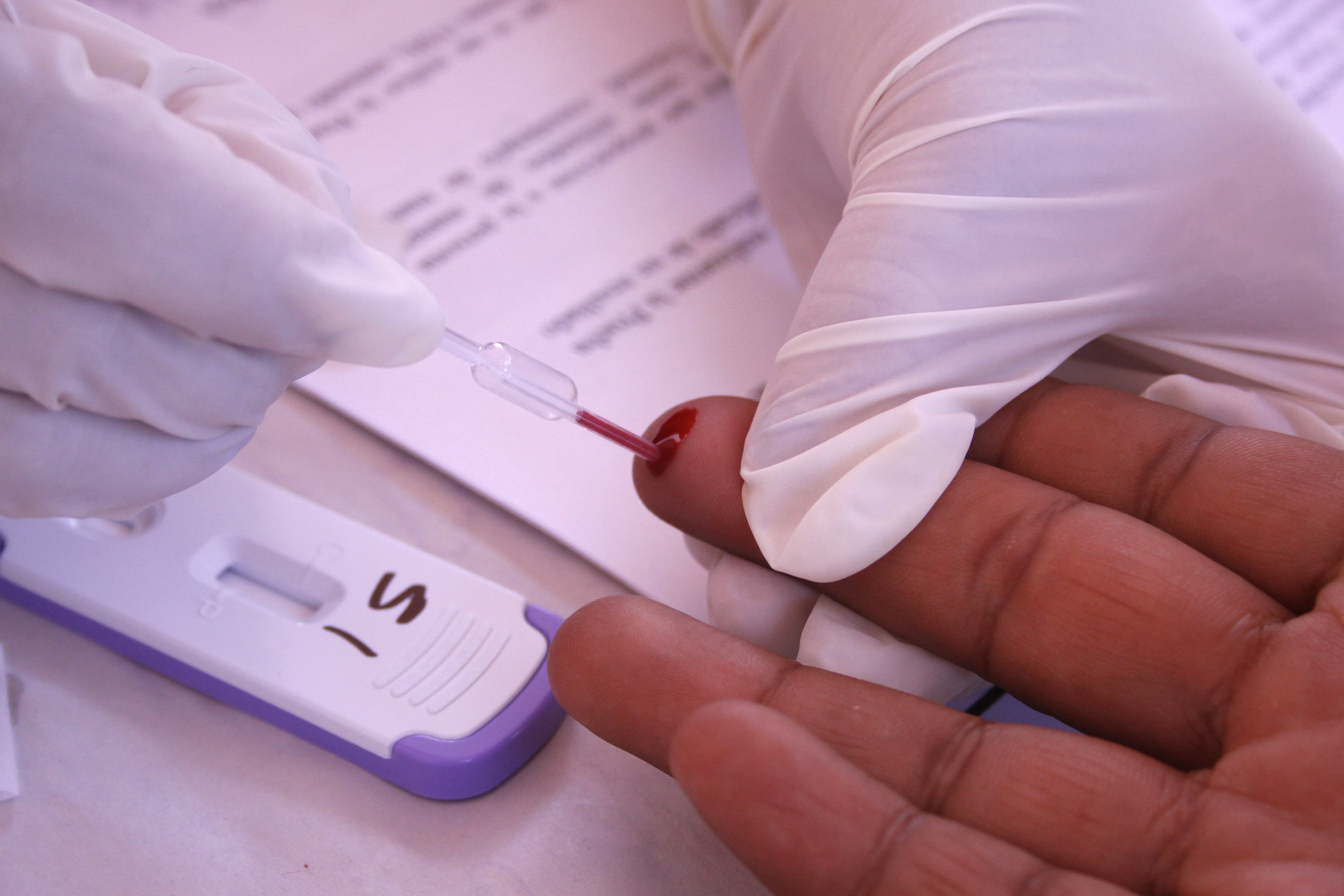 Previenen transmisión de VIH en San Martín Texmelucan