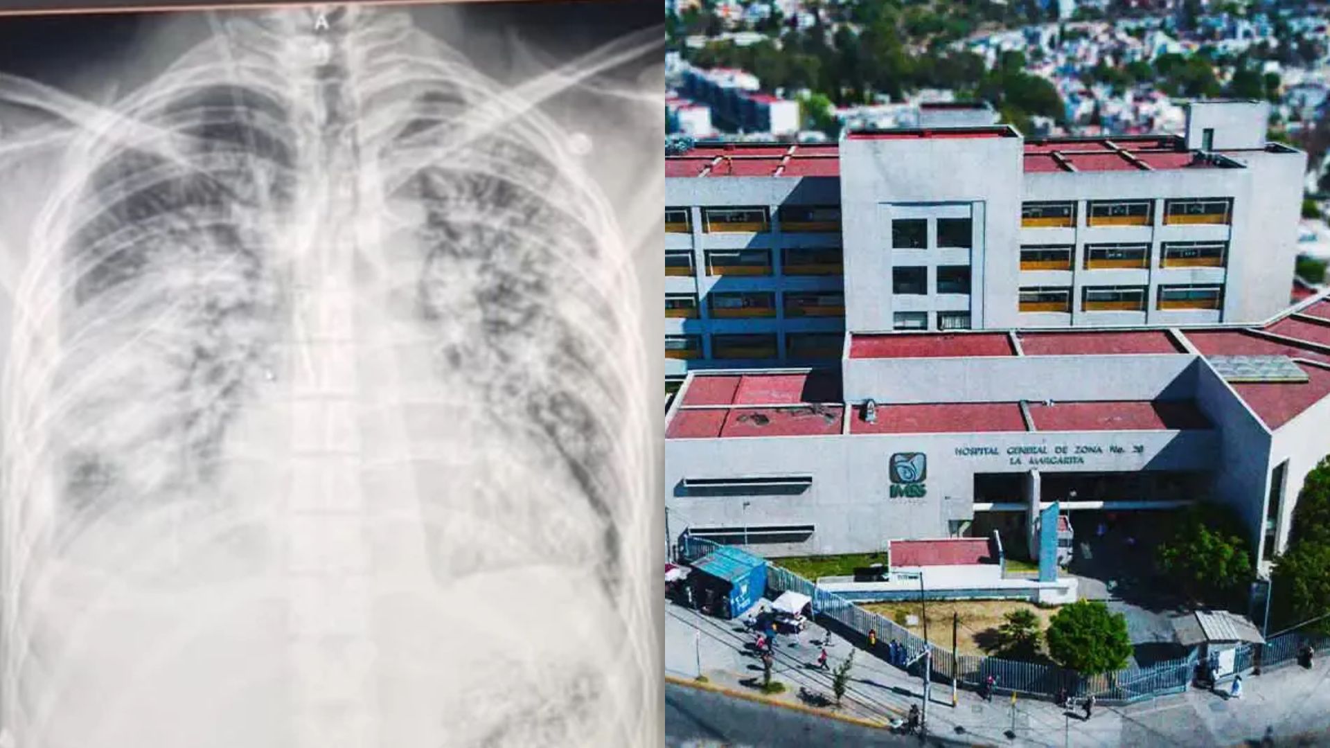 VIDEO Denuncian negligencia médica en IMSS de “La Margarita”, tras procedimiento fallido