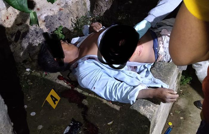 Matan a sujeto con escopetazo en la cabeza en Atzizihuacán
