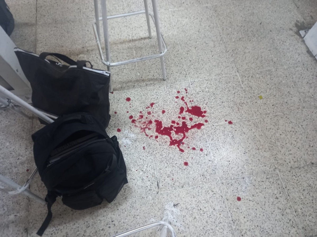 Estudiante lleva pistola a la secundaria, la acciona y sale herido