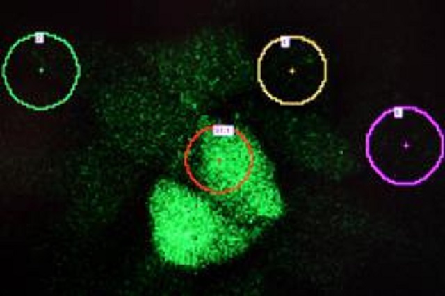 Estudio en Fisiología BUAP podría  mejorar tratamiento anti cáncer