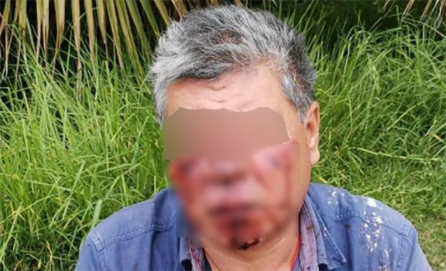 Empleado de funeraria golpea a abuelito porque no lo contrató en el IMSS La Margarita