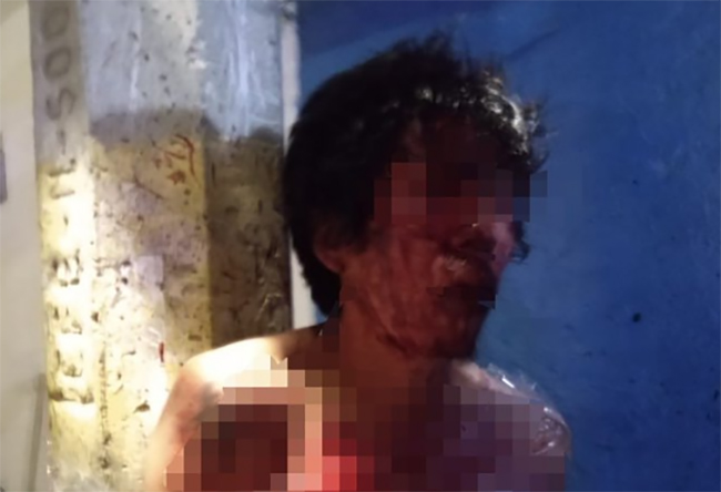 Vecinos de La Candelaria golpean y amarran a sujeto acusado de robo