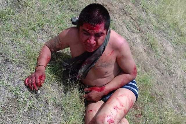 Muere asaltante golpeado por pobladores de Cuapiaxtla de Madero