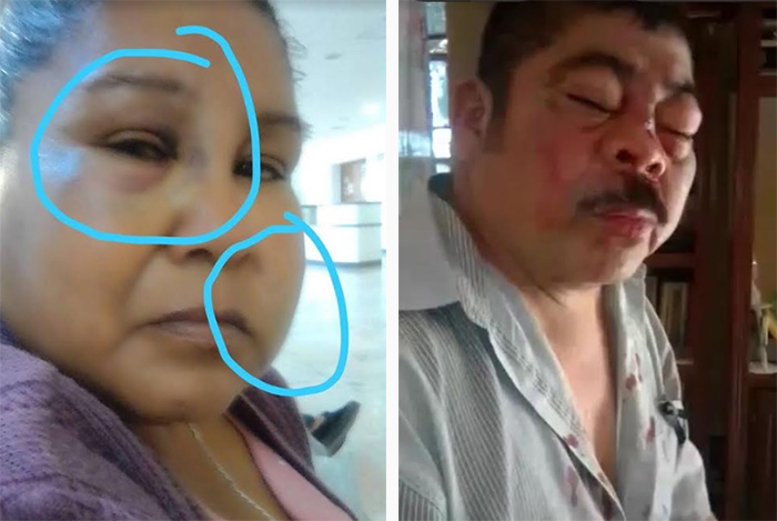 Denuncian que guarura de alcaldesa de Tepexco golpeó a una pareja