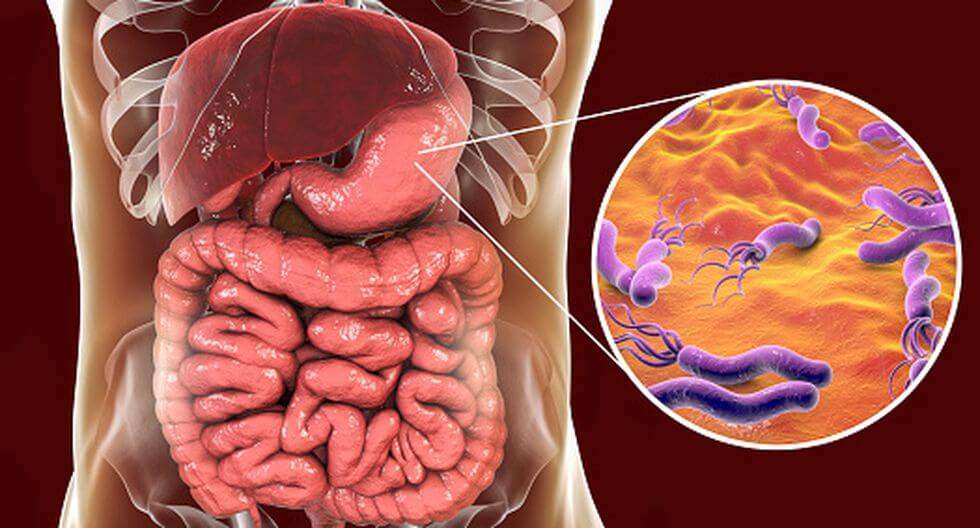 Bacteria Helicobacter pylori, causante de la mayoría de casos de gastritis en México